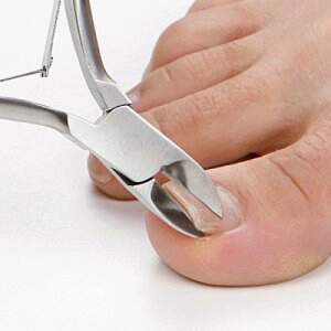 James Newman Foot Health Pracioner Es In Braintree Chelmsford What